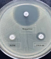 Detection of Carbapenemase Production in Klebsiella pneumoniae Isolates by Rapid Carbapenemase Detection Method in an OXA-48 Endemic Region