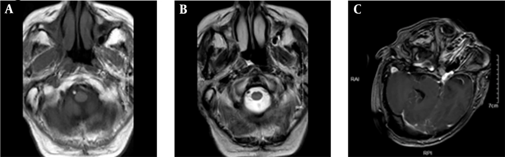 MRI images of the patient's head MRI images of the patient's head