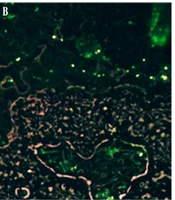 Cover image of the article: Induction of Viable but Non-culturable (VBNC) State in Shigella flexneri Under Osmotic and Nutritional Stresses at Low Temperature