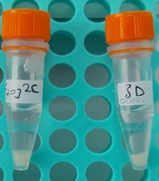 Comparison of Four Different DNA Isolation Methods from MGIT Culture for Long-Read Whole Genome Sequencing of Mycobacterium tuberculosis