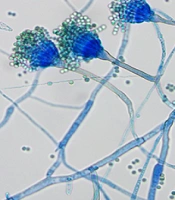 Cover image of the article: A Fatal Co-infections of Aspergillus latus and Pneumocystis jirovecii in COVID-19 Pneumonia Patient: Case Report