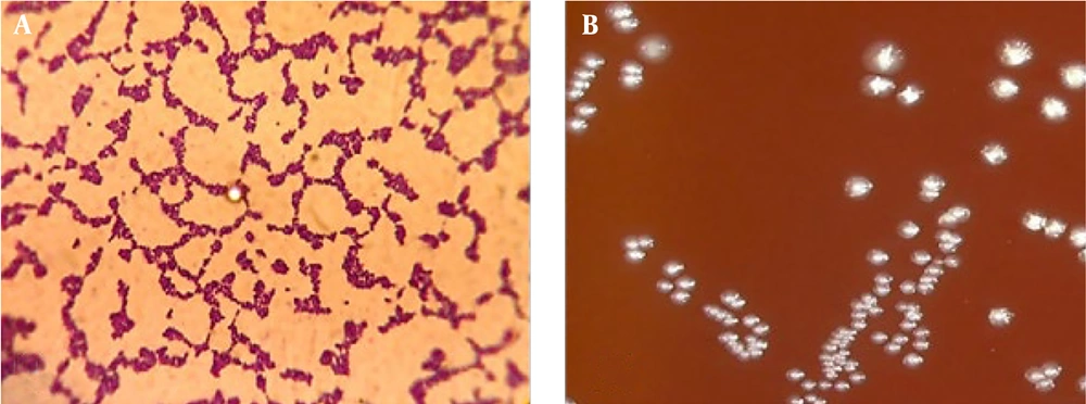 Morphological characteristics of <i>Streptococcus mutans</i>. A, gram-stain microscopic image of <i>S. mutans</i>; and B, macroscopic image of <i>S. mutans</i> colonies on blood agar culture media Morphological characteristics of <i>Streptococcus mutans</i>. A, gram-stain microscopic image of <i>S. mutans</i>; and B, macroscopic image of <i>S. mutans</i> colonies on blood agar culture media