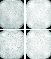 Establishment and Application of a Model for SARS-CoV-2 Infection of Human Nasal Mucosa Organoid