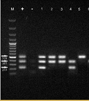 Prevalence and Virulence Gene Analysis of Mycoplasma pneumoniae Co-infection in Hospitalized COVID-19 Patients: A Case-Control Study in Iran