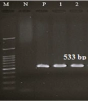 An Overview of Capsule-Encoding Genes (cap5 & cap8) in Methicillin-Resistant Staphylococcus aureus Isolated from Clinical Samples