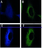 Respiratory Syncytial Virus Enhances SIRT2 Expression Through Wnt/β-Catenin Signaling to Promote Lung Cancer Progression