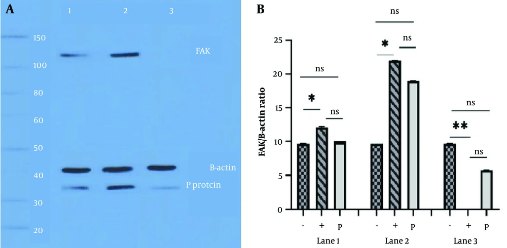 A, focal adhesion kinase (FAK) overexpression in challenge virus standard-11 (CVS-11) infected cells; lane 1, neuro2a (N2a) cells transfected with pcDNA empty vector before infection. The FAK and P protein expressions in the cell lysate were normal. Lane 2, cell transfection with pcDNA-FAK was performed, the virus was inoculated, and cell lysate blotting showed distinct bands for FAK and P protein 48 hours post-infection (hpi). Lane 3, cells in lane 2 were exposed to PF-573,228 (1 μM) two hours after virus inoculation. Cell lysate was applied to Western blot analysis 48 hpi. The lack of an FAK band is due to the inhibitory effect of PF-573,228. The low expression of the viral P protein is due to the additional influences of heat shock protein 90 (Hsp90) and cell division cycle 37 (Cdc37) chaperones. β-actin is considered a control protein; B, quantitative analysis of FAK overexpression and β-actin, in cells infected with CVS-11 and exposed to PF-573,228 (1 μM) at 48 hpi; lane 1, N2a cells were transfected with a pcDNA empty vector before infection. The (+) sign indicates the presence of FAK and the (-) sign indicates the absence of FAK, and only β-actin is present as a control. The FAK and rabies P protein expression in cell lysate were studied, and a significant difference was observed only between β-actin and FAK expression at 24 hpi (* P < 0.05). Lane 2, cell transfection with the pcDNA-FAK vector was performed before virus inoculation. Western blot analysis showed the overexpression of FAK and P protein 48 hpi. We observed significant differences in the expression of β-actin and FAK at 48 hpi (* P < 0.05). Lane 3, N2a cells were exposed to PF-573,228 (1 μM) two hours after virus inoculation, and cell lysates were detected at 48 hpi. Lack of FAK expression, due to the inhibitory effect of PF-573,228, caused significant differences (** P < 0.01). β-actin is considered a control protein. A, focal adhesion kinase (FAK) overexpression in challenge virus standard-11 (CVS-11) infected cells; lane 1, neuro2a (N2a) cells transfected with pcDNA empty vector before infection. The FAK and P protein expressions in the cell lysate were normal. Lane 2, cell transfection with pcDNA-FAK was performed, the virus was inoculated, and cell lysate blotting showed distinct bands for FAK and P protein 48 hours post-infection (hpi). Lane 3, cells in lane 2 were exposed to PF-573,228 (1 μM) two hours after virus inoculation. Cell lysate was applied to Western blot analysis 48 hpi. The lack of an FAK band is due to the inhibitory effect of PF-573,228. The low expression of the viral P protein is due to the additional influences of heat shock protein 90 (Hsp90) and cell division cycle 37 (Cdc37) chaperones. β-actin is considered a control protein; B, quantitative analysis of FAK overexpression and β-actin, in cells infected with CVS-11 and exposed to PF-573,228 (1 μM) at 48 hpi; lane 1, N2a cells were transfected with a pcDNA empty vector before infection. The (+) sign indicates the presence of FAK and the (-) sign indicates the absence of FAK, and only β-actin is present as a control. The FAK and rabies P protein expression in cell lysate were studied, and a significant difference was observed only between β-actin and FAK expression at 24 hpi (* P < 0.05). Lane 2, cell transfection with the pcDNA-FAK vector was performed before virus inoculation. Western blot analysis showed the overexpression of FAK and P protein 48 hpi. We observed significant differences in the expression of β-actin and FAK at 48 hpi (* P < 0.05). Lane 3, N2a cells were exposed to PF-573,228 (1 μM) two hours after virus inoculation, and cell lysates were detected at 48 hpi. Lack of FAK expression, due to the inhibitory effect of PF-573,228, caused significant differences (** P < 0.01). β-actin is considered a control protein.