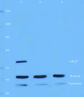 Targeting Host Proteins to Impede Rabies Virus (RABV) Replication: Insights into FAK, Hsp90, and Cdc37 Inhibition