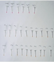 Enhancing Rapid Detection of COVID-19: Optimization of RT-LAMP Assays for Improved Sensitivity and Specificity
