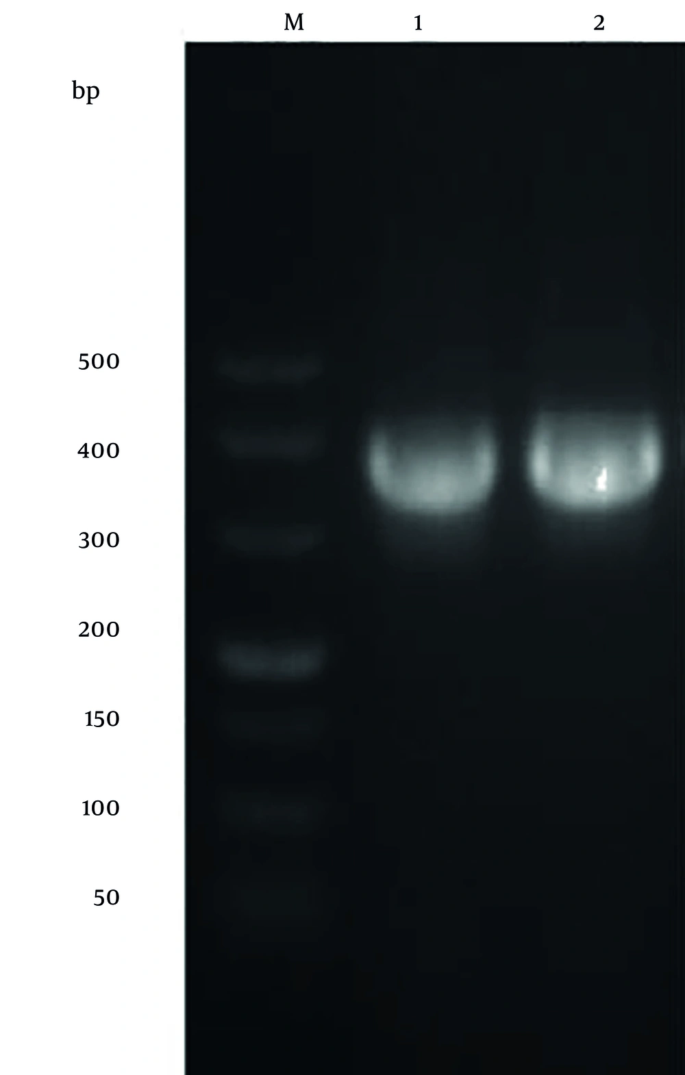 Electrophoretic profile of PCR product of L1 gene of human papillomavirus (HPV) 52. Lane M: DNA marker (50 - 500 bp). Lane 1 and 2: HPV type 52 (HPV52) L1<sub>1-141</sub> gene PCR product. Electrophoretic profile of PCR product of L1 gene of human papillomavirus (HPV) 52. Lane M: DNA marker (50 - 500 bp). Lane 1 and 2: HPV type 52 (HPV52) L1<sub>1-141</sub> gene PCR product.