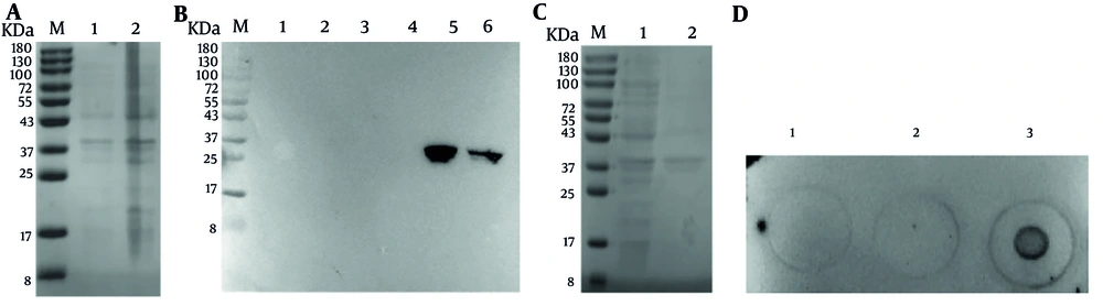 Expression and purification of human papillomavirus type 52 (HPV52) L1<sub>1-141</sub>. A, SDS-PAGE analysis of expressed HPV52 L1<sub>1-141 </sub>protein. Lane M: Protein marker (8 - 180); lane 1: Uninduced <i>Escherichia coli</i>; lane 2: Induced <i>E. coli</i>; B, western blot analysis of expressed HPV52 L1 protein. His-tag antibody was used as the primary antibody (dilution of 1:2000) ; lane M: Protein marker (8kDa-180); lane 1 and 2: Uninduced <i>E. coli</i>; lane 3 and 4: Supernatant of cell lysate after sonication and centrifugation; lane 5 and 6: Pellet of cell lysate after sonication and centrifugation; C, SDS-PAGE analysis of purified HPV52 L11-141 protein. Lane M: Protein marker (8 - 180); lane 1: Non-purified protein; lane 2: The purified HPV52 L1 protein; D, dot blotting analysis of L1 protein expression in inclusion bodies. Bacterial solution HPV52 L1<sub>1-141</sub> was uninduced (1); bacterial solution HPV52 L1<sub>1-141</sub> induced crushing supernatant (2); bacterial solution HPV52 L1<sub>1-141</sub> induced crushing and precipitation (3). Expression and purification of human papillomavirus type 52 (HPV52) L1<sub>1-141</sub>. A, SDS-PAGE analysis of expressed HPV52 L1<sub>1-141 </sub>protein. Lane M: Protein marker (8 - 180); lane 1: Uninduced <i>Escherichia coli</i>; lane 2: Induced <i>E. coli</i>; B, western blot analysis of expressed HPV52 L1 protein. His-tag antibody was used as the primary antibody (dilution of 1:2000) ; lane M: Protein marker (8kDa-180); lane 1 and 2: Uninduced <i>E. coli</i>; lane 3 and 4: Supernatant of cell lysate after sonication and centrifugation; lane 5 and 6: Pellet of cell lysate after sonication and centrifugation; C, SDS-PAGE analysis of purified HPV52 L11-141 protein. Lane M: Protein marker (8 - 180); lane 1: Non-purified protein; lane 2: The purified HPV52 L1 protein; D, dot blotting analysis of L1 protein expression in inclusion bodies. Bacterial solution HPV52 L1<sub>1-141</sub> was uninduced (1); bacterial solution HPV52 L1<sub>1-141</sub> induced crushing supernatant (2); bacterial solution HPV52 L1<sub>1-141</sub> induced crushing and precipitation (3).
