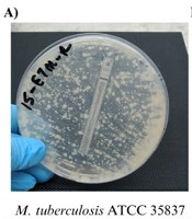 Evaluation of the Activity of Amoxicillin/Clavulanate, Ceftazidime/Avibactam and Colistin Against Drug-Resistant Mycobacterium tuberculosis Isolates by the E-test Method