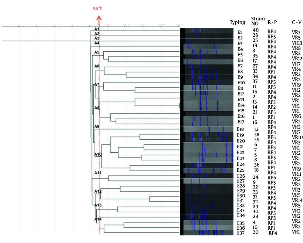 Enterobacterial repetitive intergenic consensus (ERIC)-PCR fingerprint profiles and UPGMA dendrogram of 40 clinical <i>Acinetobacter</i> isolates: The dendrogram (left) displays genetic relationships among 40 isolates based on ERIC-PCR banding patterns, analyzed by the unweighted pair group method with arithmetic mean (UPGMA). The Similarity Scale is shown at the top, and clusters (A1 - A14) are defined at a 55% similarity threshold (red dashed line). The central panel shows ERIC-PCR electropherograms, with blue bands representing DNA fragments. The right panel presents isolate information: Typing (ERIC type), strain No. (1 - 40), R-P (resistance profile; RP1 - RP5, refer to <a href="#A162057FIG1">Figure 1</a>), and C-V (combined virulence gene profile; VR1 - VR14, refer to <a href="#A162057FIG2">Figure 2</a>). Enterobacterial repetitive intergenic consensus (ERIC)-PCR fingerprint profiles and UPGMA dendrogram of 40 clinical <i>Acinetobacter</i> isolates: The dendrogram (left) displays genetic relationships among 40 isolates based on ERIC-PCR banding patterns, analyzed by the unweighted pair group method with arithmetic mean (UPGMA). The Similarity Scale is shown at the top, and clusters (A1 - A14) are defined at a 55% similarity threshold (red dashed line). The central panel shows ERIC-PCR electropherograms, with blue bands representing DNA fragments. The right panel presents isolate information: Typing (ERIC type), strain No. (1 - 40), R-P (resistance profile; RP1 - RP5, refer to <a href="#A162057FIG1">Figure 1</a>), and C-V (combined virulence gene profile; VR1 - VR14, refer to <a href="#A162057FIG2">Figure 2</a>).