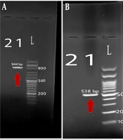 Jundishapur J Microbiol