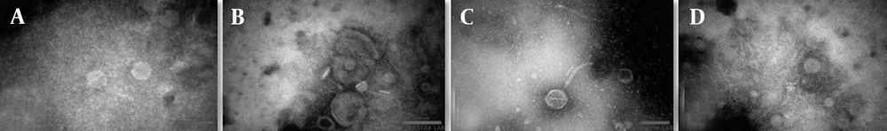 Morphological analysis of phages PhSal01, PhSal04, PhSal06, and PhSal05 using transmission electron microscopy (TEM) – TEM images showing A, PhSal01 (<i>Siphoviridae</i>) with an elongated, noncontractile tail measuring 7 × 102 nm and a head with dimensions of 64 × 71 nm; B,PhSal04 (<i>Siphoviridae</i>) with a head diameter of 37 × 40 nm and a thin tail length of 8 × 153 nm; C, PhSal06 classified under the <i>Myoviridae</i> family, characterized by its robust, contractile tail measuring 15 × 152 nm and a head diameter of 71 × 72 nm; and D, PhSal05 (<i>Siphoviridae</i>) with a head diameter of 25 × 30 nm and a thin tail length of 7 × 70 nm. Morphological analysis of phages PhSal01, PhSal04, PhSal06, and PhSal05 using transmission electron microscopy (TEM) – TEM images showing A, PhSal01 (<i>Siphoviridae</i>) with an elongated, noncontractile tail measuring 7 × 102 nm and a head with dimensions of 64 × 71 nm; B,PhSal04 (<i>Siphoviridae</i>) with a head diameter of 37 × 40 nm and a thin tail length of 8 × 153 nm; C, PhSal06 classified under the <i>Myoviridae</i> family, characterized by its robust, contractile tail measuring 15 × 152 nm and a head diameter of 71 × 72 nm; and D, PhSal05 (<i>Siphoviridae</i>) with a head diameter of 25 × 30 nm and a thin tail length of 7 × 70 nm.