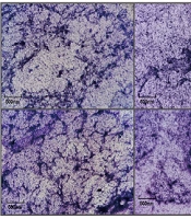 Fosfomycin Attenuates Virulence of Multidrug-Resistant Pseudomonas aeruginosa by Quorum-Sensing Inhibition and Protects Mice from Acute Lung Injury