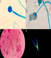 Jundishapur J Microbiol