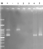 Jundishapur J Microbiol