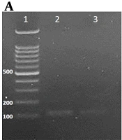 Association Between Human Cytomegalovirus Infection and Spontaneous Abortion Among Pregnant Women: Evidence from Al-Muthanna Province, Iraq