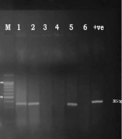 Jundishapur J Microbiol