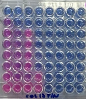 Jundishapur J Microbiol