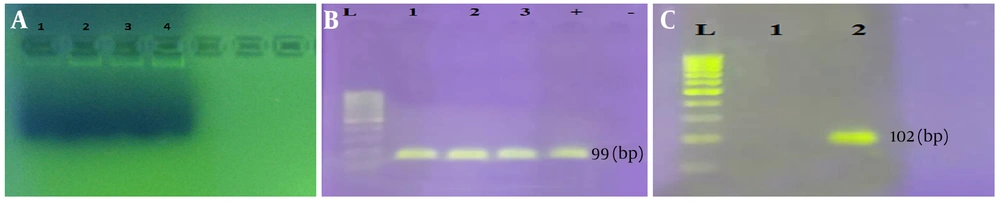 A, Validation of the extracted DNAs from EAEC clinical isolates involved in urinary infections in medical laboratories in Boroujerd, west of Iran. B, Identification of the 16S rRNA gene fragment (length: 99 bp) in EAEC clinical isolates. C, Amplification of the aggR gene (length: 102 bp) in the EAEC clinical isolates. DNA marker: 50 bp. A, Validation of the extracted DNAs from EAEC clinical isolates involved in urinary infections in medical laboratories in Boroujerd, west of Iran. B, Identification of the 16S rRNA gene fragment (length: 99 bp) in EAEC clinical isolates. C, Amplification of the aggR gene (length: 102 bp) in the EAEC clinical isolates. DNA marker: 50 bp.
