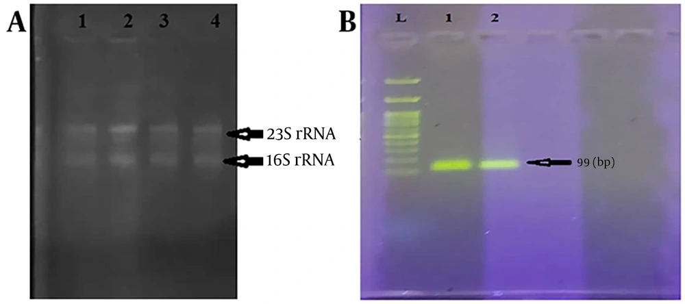 A, Amplification plot of the aggR gene in the isolated EAEC clinical sample involved in urinary infections in medical laboratories in Boroujerd, west of Iran (ΔRn cycle). B, Melt-curve analysis to ensure the specificity of the amplified aggR gene fragment. The amplification peaks are aligned with each other. A, Amplification plot of the aggR gene in the isolated EAEC clinical sample involved in urinary infections in medical laboratories in Boroujerd, west of Iran (ΔRn cycle). B, Melt-curve analysis to ensure the specificity of the amplified aggR gene fragment. The amplification peaks are aligned with each other.