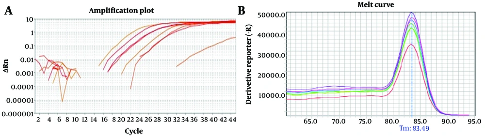 A, Quality of the purified RNAs in negative control and samples treated with creatinine concentrations (1, 3, and 6 mg/dL) (lanes 1 - 4); two specific 16S and 23S RNA bands are indicative of the integrity and purity of the extracted RNA. B, cDNA quality control. A, Quality of the purified RNAs in negative control and samples treated with creatinine concentrations (1, 3, and 6 mg/dL) (lanes 1 - 4); two specific 16S and 23S RNA bands are indicative of the integrity and purity of the extracted RNA. B, cDNA quality control.