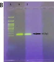 Evaluation of Escherichia coli aggR Gene Expression in the Presence of Different Concentrations of Creatinine