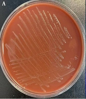 Urethritis Caused by Neisseria meningitidis: A Case Report