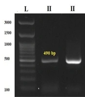 ACE Polymorphism and Clinical Outcomes in Iranian Patients with COVID-19