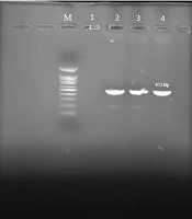 Prevalence of the luxS Gene and Biofilm Formation in Urinary Tract Klebsiella pneumoniae Isolates
