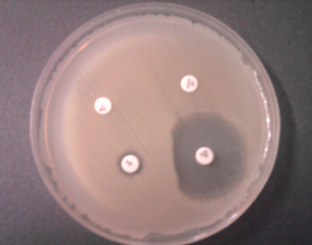 Inducible Clindamycin Resistance (D-test) Flattening of the clindamycin zone adjacent to the erythromycin disk produces a D shape.