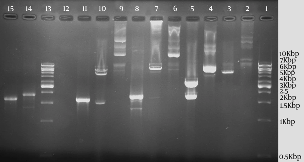 Polymerase Chain Reaction Amplification and Restriction Enzyme Analyses of Different Plasmids by <i>NdeI</i> and <i>XhoI </i>Restriction Enzymes and Comparison of Undigested and Digested Patterns of Plasmids With orf2.1 and orf2.2 on Agarose Gel Electrophoresis PCR amplification and restriction enzyme analyses of plasmids pBluescript II SK-ORF2.1, pET30a-ORF2.1, pET30a-ORF2.2, and pET30a+ without ORF2.1 by <i>NdeI</i> and <i>XhoI </i>restriction enzymes. Lane 1, the 1kb DNA marker; Lane 2, the undigested plasmid pET30a+; Lane 3, the digested plasmid pET30a+; Lane 4, the undigested pBluescript II SK-ORF2.1; Lane 5, the digested pBluescript II SK-ORF2.1; Lane 6, the undigested plasmid pET30a-ORF2.1; Lane 7, the digested plasmid pET30a- ORF2.1; Lane 8, the amplified <i>orf2.1</i> gene by PCR (with T7 promoter and T7 terminator primers); Lane 9, the undigested plasmid pET30a-ORF2.2; Lane 10, the digested plasmid pET30a-ORF2.2; Lane 11, the amplified <i>orf2.2</i> gene by PCR (with T7 promoter and T7 terminator primers); Lane 13, the 1 kb DNA marker; Lane 14, the amplified <i>orf2.1</i> gene by PCR; and Lane 15, the amplified <i>orf2.2</i> gene by PCR.