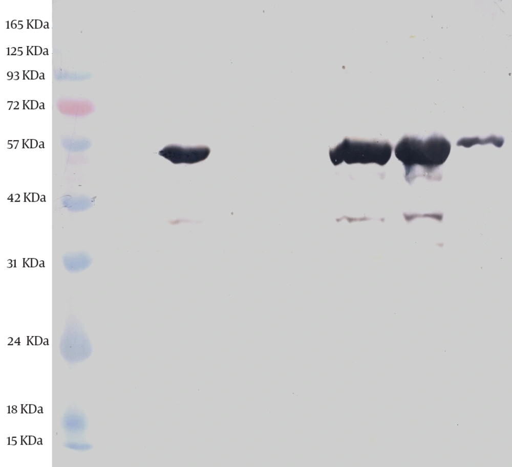 Western Blot Analysis of the Expressed and Purified ORF2.2 Protein in <i>E. coli</i> The ORF2 protein band is seen at about 55 kDa. Lane 1, the prestained protein ladder; Lane 2, the noninduced control; Lane 3, Inducing for fourhours; Lane 4, flow-through; Lane:5, wash; Lane: 6 to 8, the first, the second, and the third eluates.