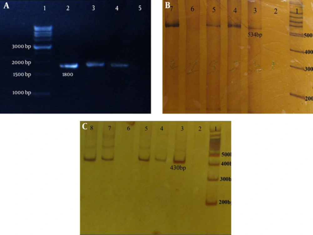 Agarose gel electrophoresis of <i>sabA</i> and polyacrylamid gel of <i>hopQI</i> and <i>hopQII</i> genes in <i>H. pylori</i> isolates. A, <i>H. pylori sabA</i>: lane 1: 1kb DNA ladder marker, lanes 2 - 4 (1800 bp): <i>sabA</i> positive strains, and lane 5 is negative for <i>sabA</i>. B, <i>H. pylori </i><i>hopQI</i>: lane 1: 100 bp DNA ladder marker, lanes 3 - 5 and 7 (525 bp): <i>hopQI</i> positive strains and lanes 2 and 6 are negative for <i>hop QI</i>. C, <i>H. pylori hopQII</i>: lane 1: 100 bp DNA ladder marker, lanes 3 - 5 and 7 - 8 (430 bp): <i>hopQII</i> positive strains, and lanes 2 and 6 are negative for <i>hopQII.</i> Agarose gel electrophoresis of <i>sabA</i> and polyacrylamid gel of <i>hopQI</i> and <i>hopQII</i> genes in <i>H. pylori</i> isolates. A, <i>H. pylori sabA</i>: lane 1: 1kb DNA ladder marker, lanes 2 - 4 (1800 bp): <i>sabA</i> positive strains, and lane 5 is negative for <i>sabA</i>. B, <i>H. pylori </i><i>hopQI</i>: lane 1: 100 bp DNA ladder marker, lanes 3 - 5 and 7 (525 bp): <i>hopQI</i> positive strains and lanes 2 and 6 are negative for <i>hop QI</i>. C, <i>H. pylori hopQII</i>: lane 1: 100 bp DNA ladder marker, lanes 3 - 5 and 7 - 8 (430 bp): <i>hopQII</i> positive strains, and lanes 2 and 6 are negative for <i>hopQII.</i>
