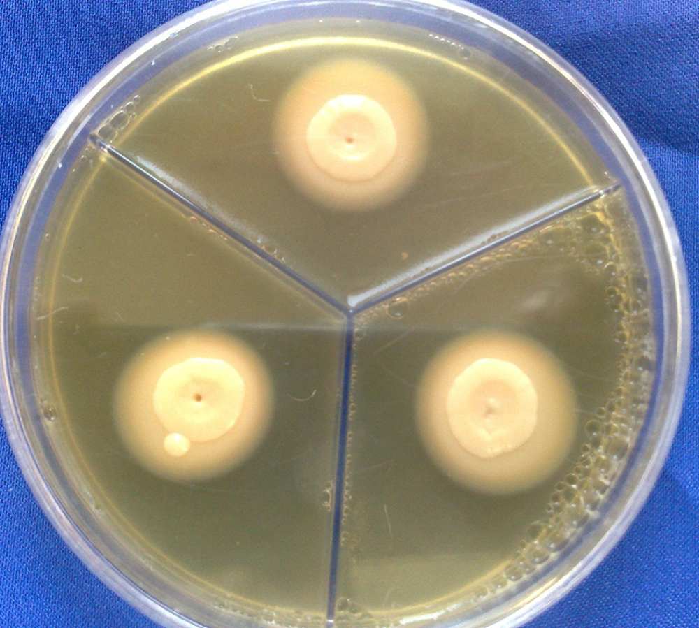 Phospholipase Precipitation Zone Around <i>C. albicans</i> Phospholipase Precipitation Zone Around <i>C. albicans</i>
