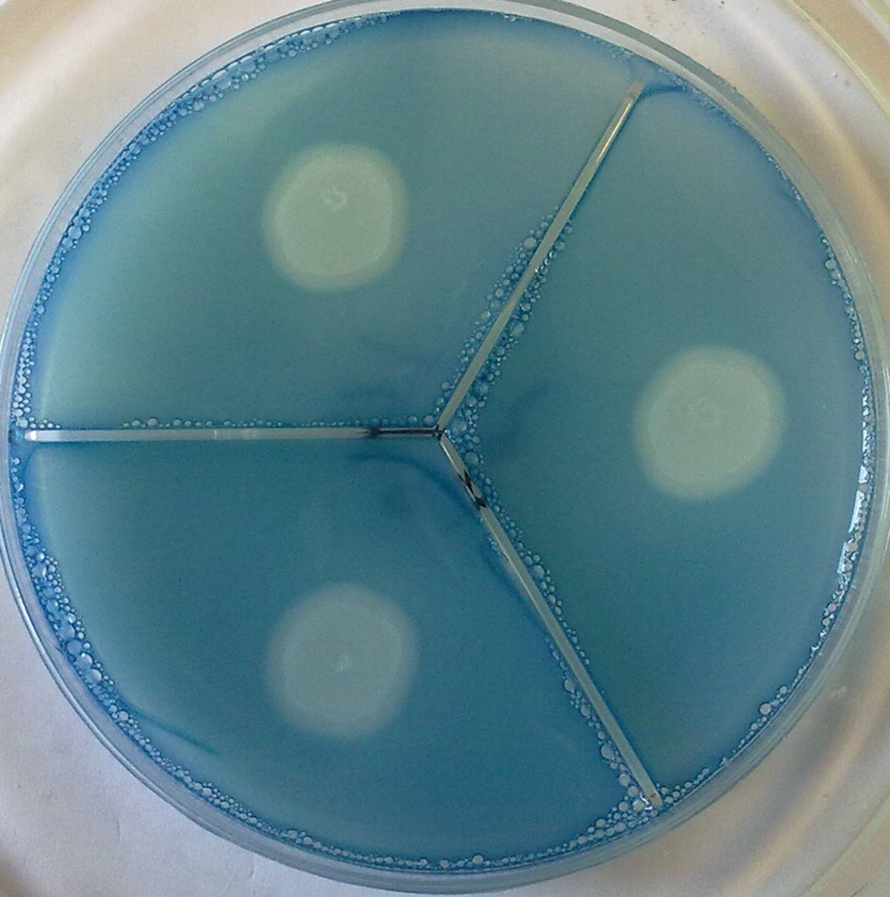 Proteinase Clear Zone Around C. <i>albicans</i> (Stained With Amido Black) Proteinase Clear Zone Around C. <i>albicans</i> (Stained With Amido Black)