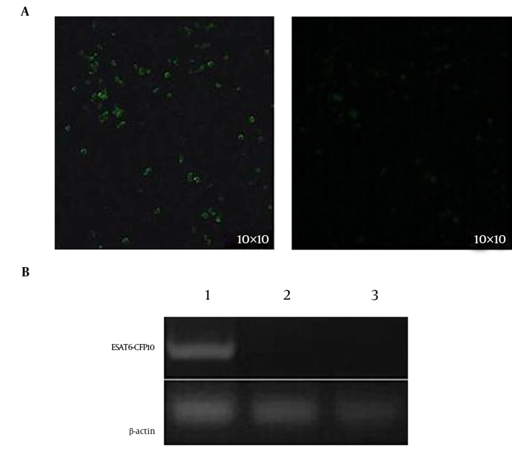 Identification of the NR8383-EC Cell Line Expressing the ESAT6-CFP10 Protein With Fluorescence and RT-PCR The ESAT6-CFP10 was fused to the N terminal of GFP of the pEGFP-N1 expression vector. A, the expression of the fusion protein was detected with fluorescence signals, using a fluorescence microscope; 1, NR8383 transfected with the recombinant eukaryotic plasmid pEGFP-N1-ESAT6-CFP10; 2, NR8383 non-transfected with the recombinant eukaryotic plasmid pEGFP-N1-ESAT6-CFP10; B, the mRNA level of ESAT6-CFP10 was analyzed with RT-PCR using total RNA extracted from cells; lane 1, the gene amplified from the NR8383-EC cells; lane 2, the gene amplified from NR8383 cells transfected with pEGFP-N1 plasmid; Lane 3, the gene amplified from non-transfected NR8383 rat alveolar macrophages.