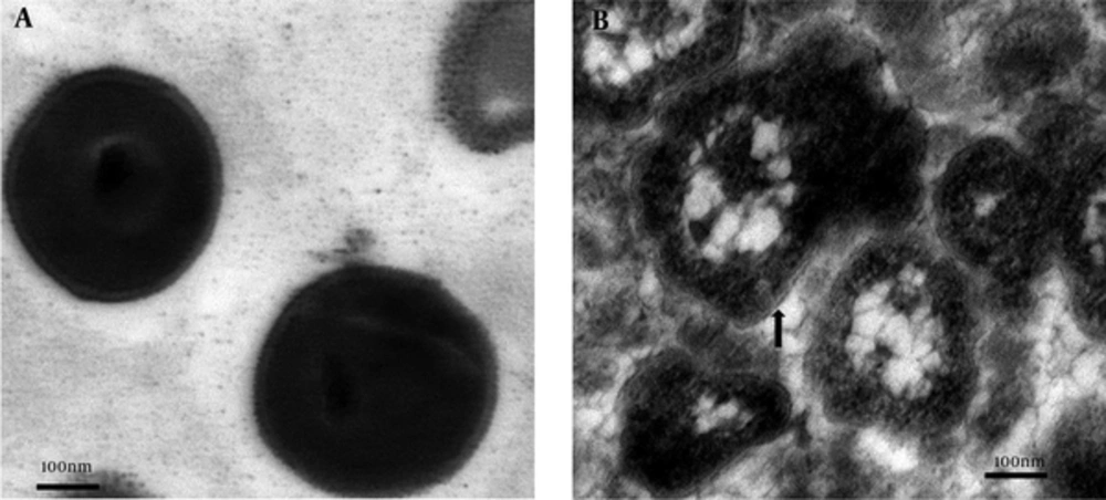 The shape and structure of <i>S. aureus</i> normal and L-form cells (TEM) A, Normal <i>S. aureus</i> cells with spherical shape and thick cell wall; B, <i>S. aureus</i> L-forms displaying a variety of morphological types with completely or partially missing cell wall (black arrow).