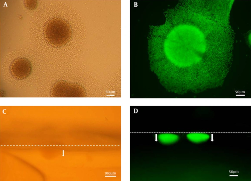 Comparison of the shape and growth properties of the <i>S. aureus</i> Newman strain and Newman-pCM29 reporter strain L-form colonies on LIM A, The “fried egg” colonies of <i>S. aureus</i> Newman strain L-form; B, The “fried egg” colonies of <i>S. aureus</i> Newman-pCM29 reporter strain L-form under fluorescence microscopy; C, Vague core of <i>S. aureus</i> Newman strain L-form colony embedded into the agar (arrow); D, Definite cores of <i>S. aureus</i> Newman-pCM29 reporter strain L-form colonies embedded into the soft agar (arrows). The dotted lines represent the LIM surface plane.