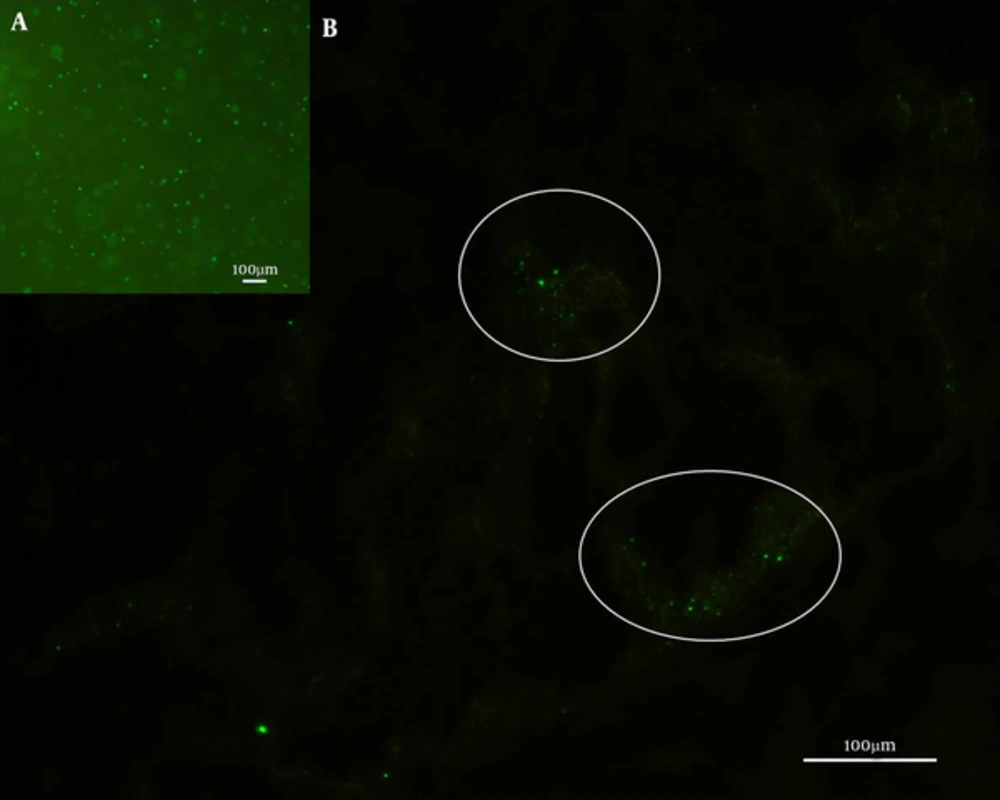 <i>S. aureus</i> Newman-pCM29 L-forms in suspension for mice subcutaneous injection (A) and the fluorescence reported bacteria in mouse subcutaneous lesion after <i>S. aureus</i> Newman-pCM29 L-forms were injected 120 hours (B) (circles) <i>S. aureus</i> Newman-pCM29 L-forms in suspension for mice subcutaneous injection (A) and the fluorescence reported bacteria in mouse subcutaneous lesion after <i>S. aureus</i> Newman-pCM29 L-forms were injected 120 hours (B) (circles)