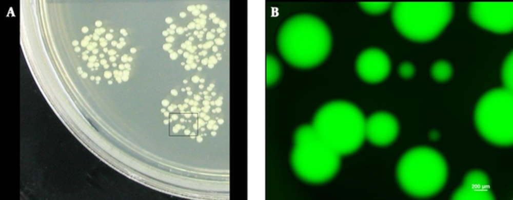 <i>S. aureus</i> viable cells from lesions A, Colonies of varying sizes (black box); B, Cells observed under fluorescence microscope. All the colonies inside the black box emitted green fluorescence.