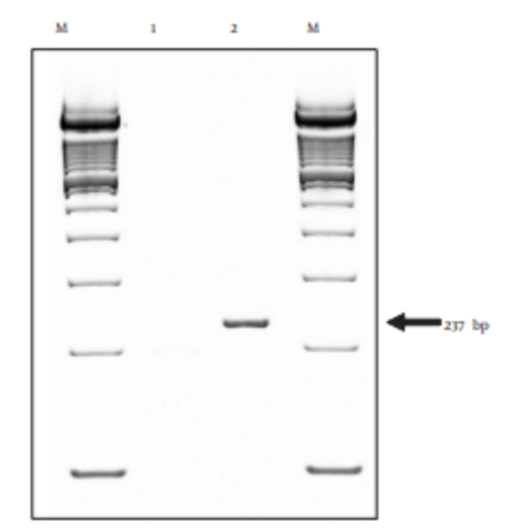 Detection of TLR4 mRNA Expression on Different Kinds of Cattle Cells by qRT-PCR Analysis Lane 1, BFF_NCC1 cells; lane 2, PBMCs; M, marker (100-bp DNA ladder).