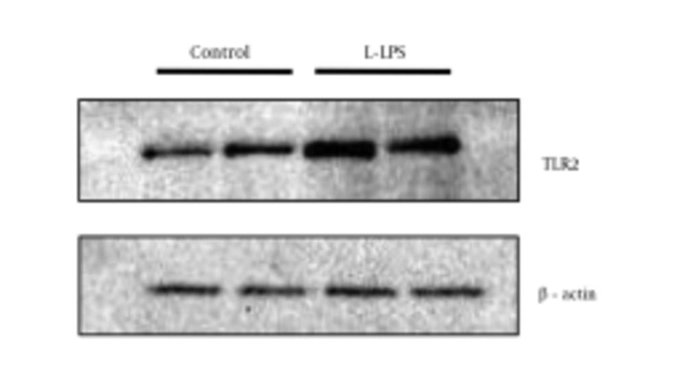TLR2 Protein Expression After Exposure to L-LPS in BFF_NCC1 Cells, Based on Western Blotting Analysis Cells were stimulated by 1 μg/mL of L-LPS for 6 hours. Unstimulated cells were used as a control. The two lanes shown for the respective experimental conditions are the results obtained from duplicate experiments in which the cells were separately prepared. Anti-β-actin polyclonal antibody was used to detect β-actin as a loading control.