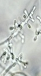 Cover image of the article: Determination of Changes in the Expression of MIR-212 and EGFR Genes in Clinical Samples from Areas Infected with Trichophyton rubrum Compared with Non-Infected Areas