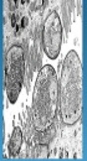 Cover image of the article: Gene Profile Expression Related to Type I Interferons in HT-29 Cells Exposed to Cryptosporidium parvum