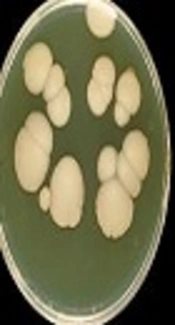 Identification of Candida Species Isolated from Vulvovaginal Candidiasis Patients by Polymerase Chain Reaction-Restriction Fragment Length Polymorphism (PCR-RFLP) in Yasuj Southwestern Iran