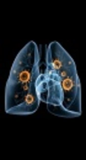 Fungi Identified in Patients with Recurrent Lung Disorders