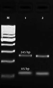 A Survey of gyrA Target-Site Mutation and qnr Genes among Clinical Isolates of Escherichia coli in the North of Iran